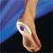 hielspoor? Fascitis plantaris